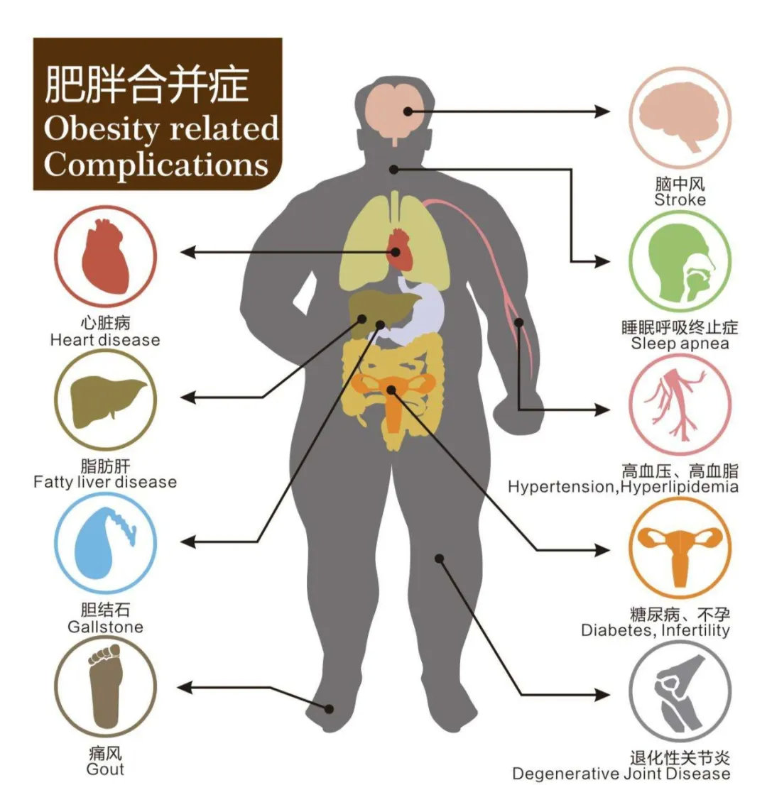 发福不是福宣络堂减肥瘦身肥胖危害太大减肥刻不容缓